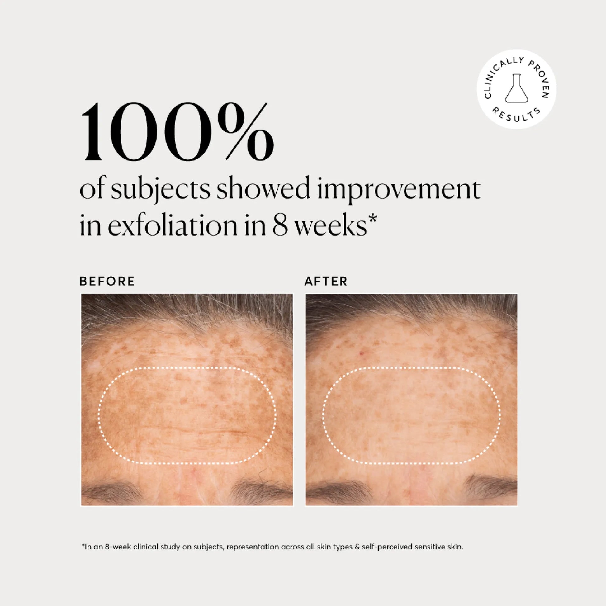 bha-liquid-exfoliant-2-h2 NATR-10027-Alt-Images-BHA-Liquid-Exfoliant-2_-03.webp