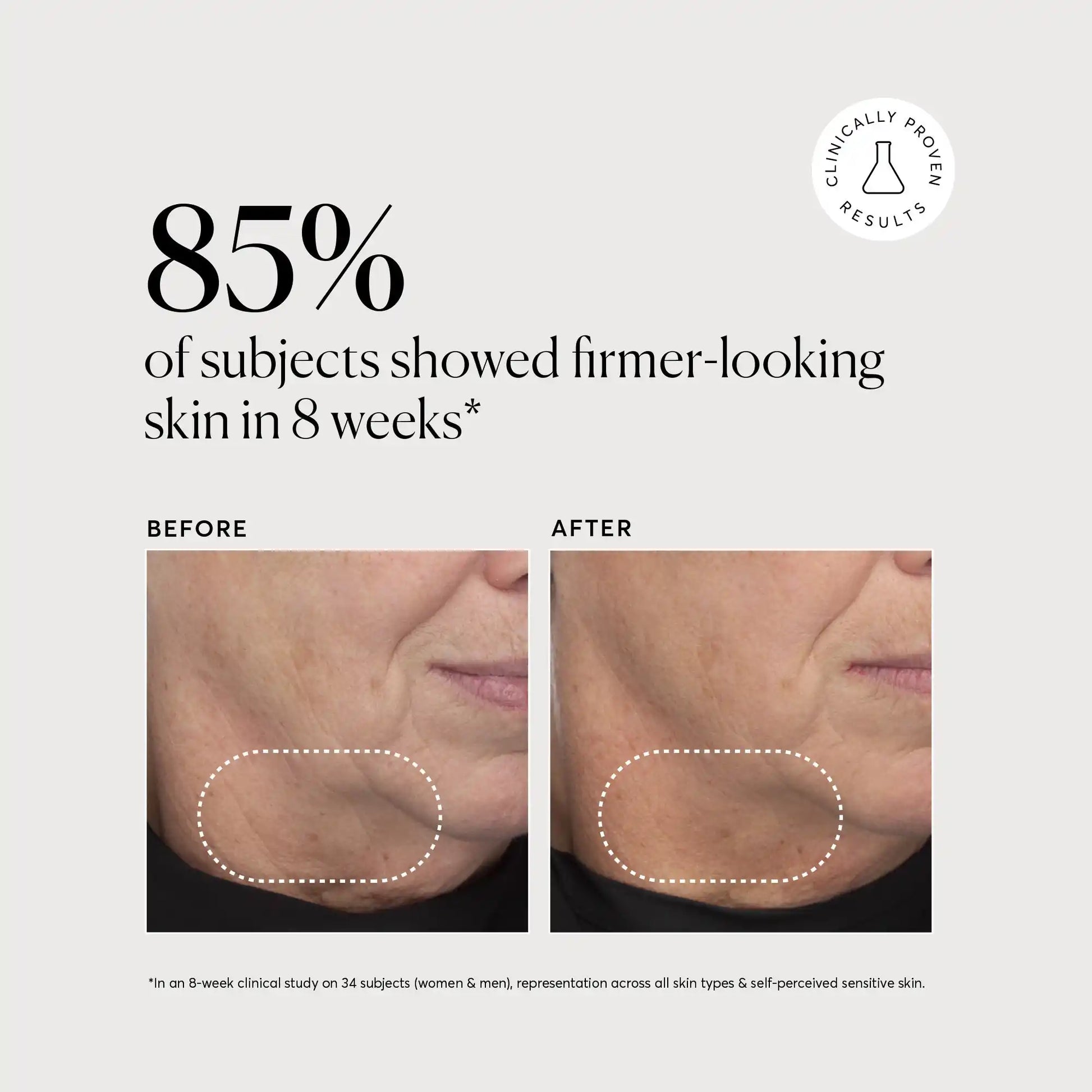 retinol-complex-serum-q8 NATR-10034-Alt-Images-Retinol-Complex-Serum-04.webp